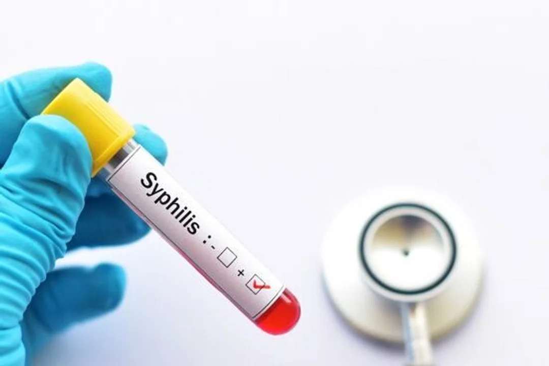 Sifilis